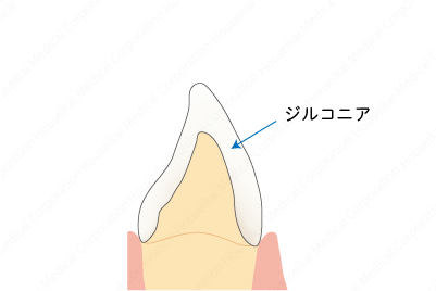 crown-b-02